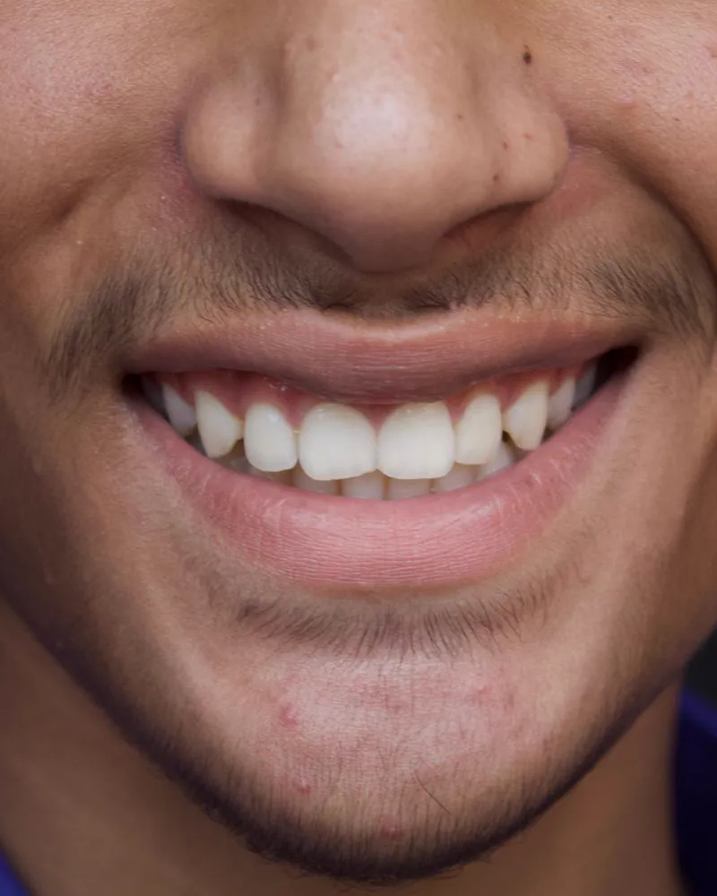 Gabinete dental preparado para un tratamiento estético