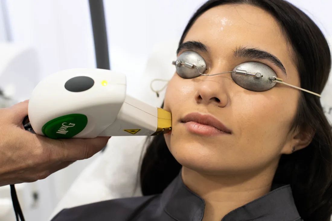 Tratamiento de rejuvenecimiento facial con l&aacute;ser