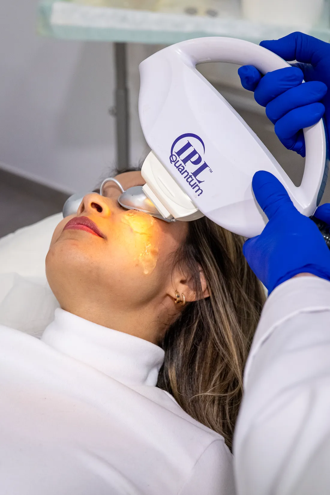 Tratamiento con l&aacute;ser IPL